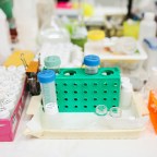 Signs You Need to Take Chlamydia Test