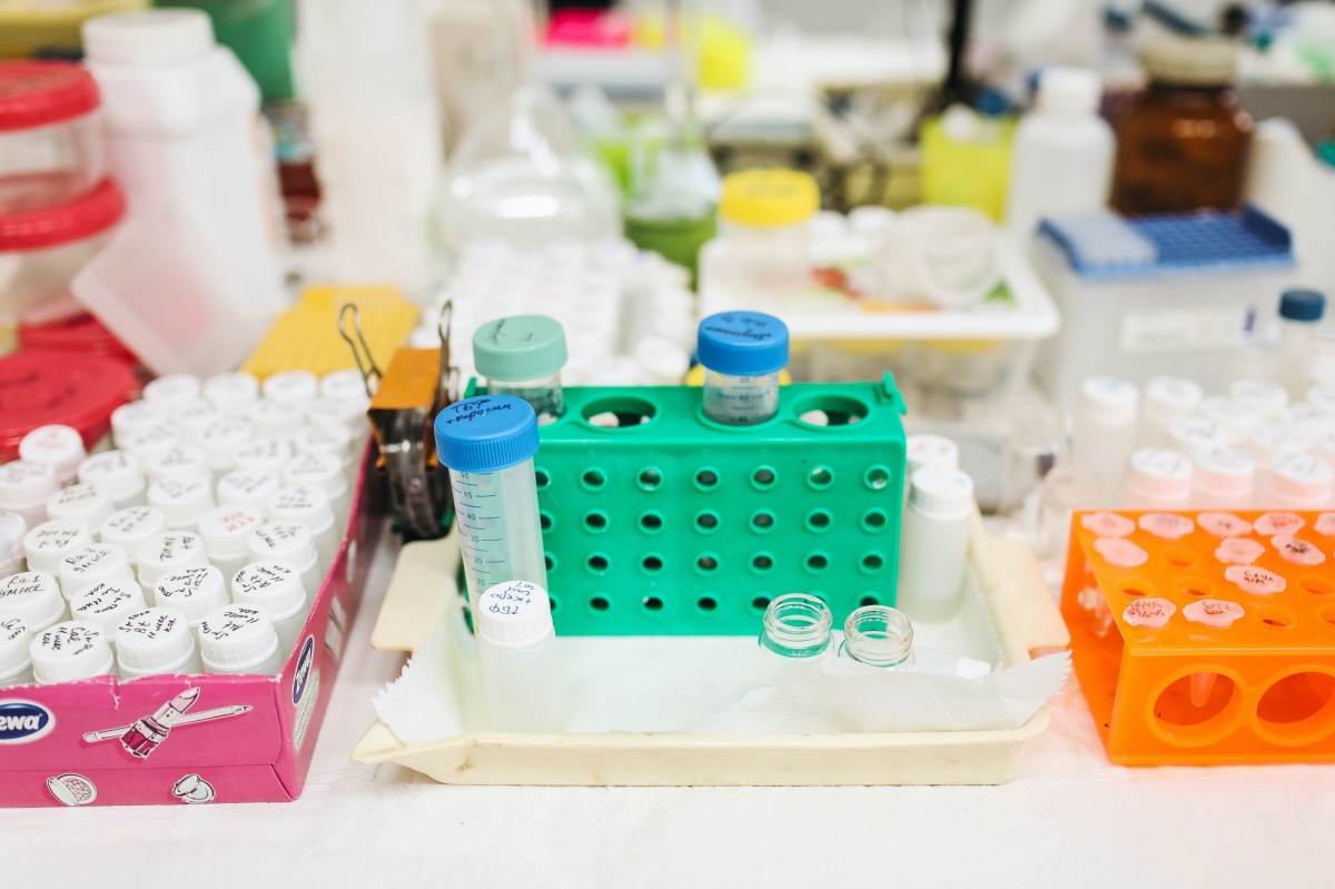 Signs You Need to Take Chlamydia Test